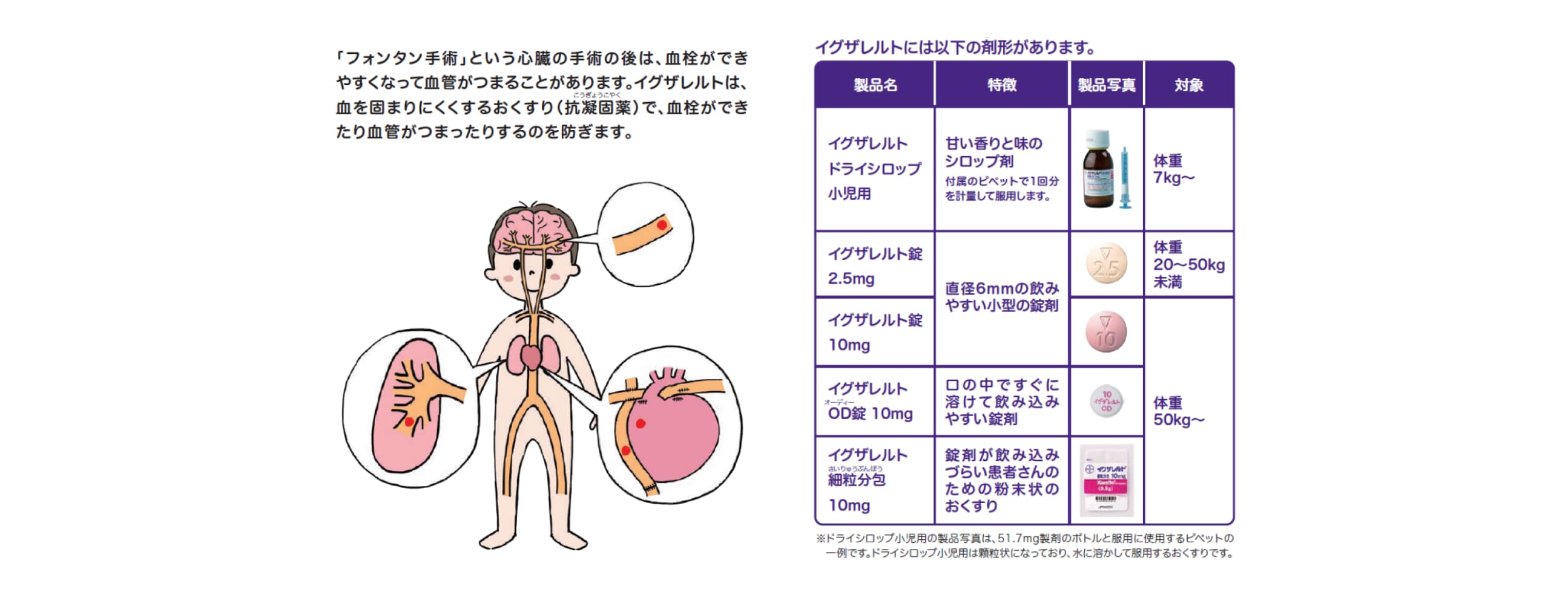イグザレルトはどのようなおくすりですか？