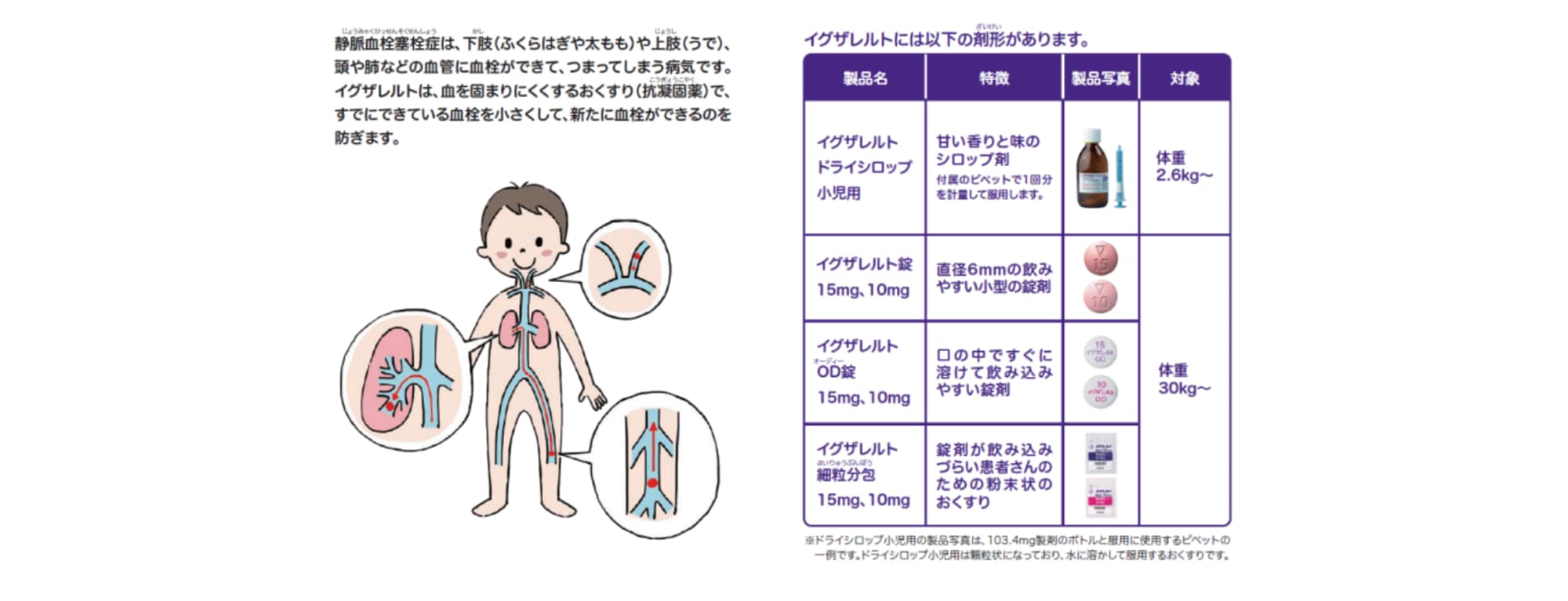 イグザレルトはどのようなおくすりですか？