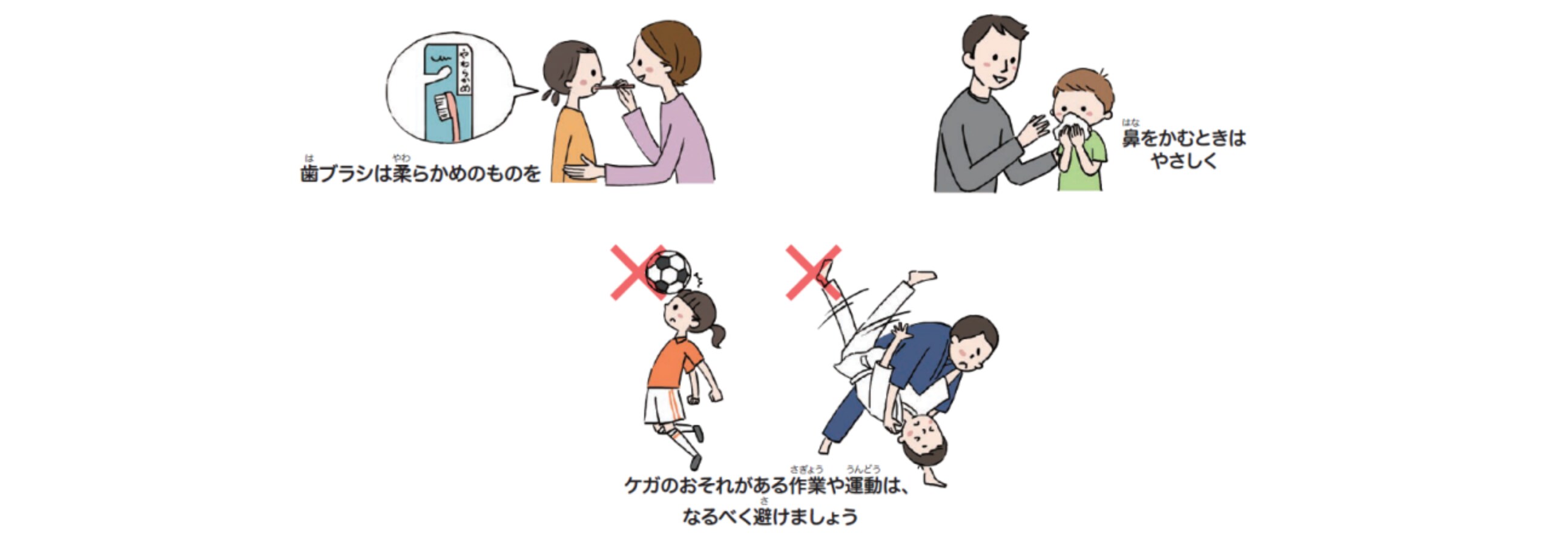 出血を避けるために心がけることは何ですか？ イグザレルトでは、他にどのような症状が起こりますか？ イグザレルトの服用中、気をつけることはありますか？ 主治医または薬剤師に指示された量と回数を守って飲んでください。  イグザレルトドライシロップ小児用の調製方法および服用方法の詳細についてはこちらから 飲み忘れた場合は、1日の服用回数に応じて、以下のように対応してください。 鼻や歯ぐきからの出血、皮下出血(あおあざ)が起こりやすくなります。女児の場合には、月経時の出血量が増える ことがあります。ときに重大な出血が起こるおそれもありますので、服用中は十分に注意してください。  出血が気になる場合は、すぐに主治医に連絡してください。 普段の生活の中で、次の点に注意してください。 皮膚が黄色っぽくなる、息が切れるなどの症状がまれに出ることがあります。 次のようなことがある場合は、 必ず事前に相談してください。 閉じる 閉じる 閉じる 閉じる 閉